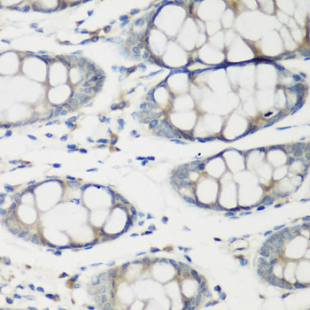TNNC2 Rabbit polyclonal antibody