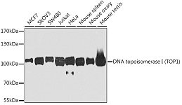 Western blot - DNA topoisomerase I (TOP1) Rabbit pAb (A7741)