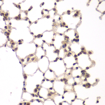 [KO Validated] VRK1 Rabbit polyclonal antibody