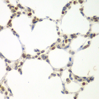 [KO Validated] VRK1 Rabbit polyclonal antibody