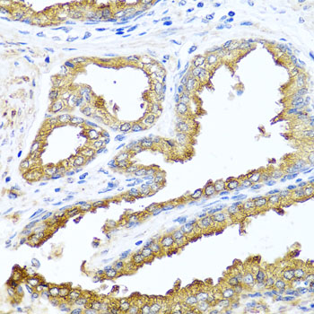 NCK2 Rabbit polyclonal antibody