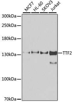 TTF2 Rabbit polyclonal antibody