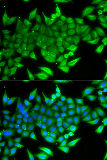 TTF2 Rabbit polyclonal antibody