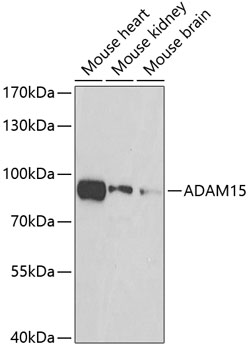 ADAM15 Rabbit polyclonal antibody