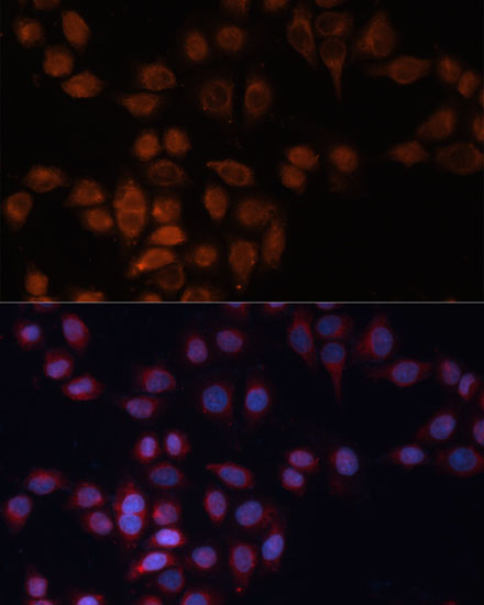 ADAM15 Rabbit polyclonal antibody