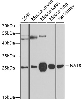 NAT8 Rabbit polyclonal antibody