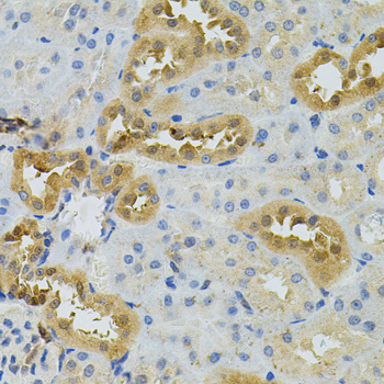 NAT8 Rabbit polyclonal antibody