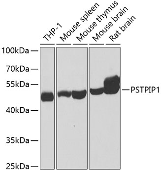 PSTPIP1 Rabbit polyclonal antibody