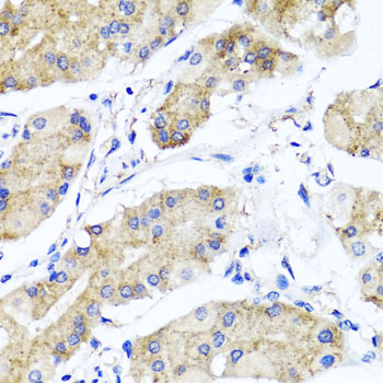 PSTPIP1 Rabbit polyclonal antibody