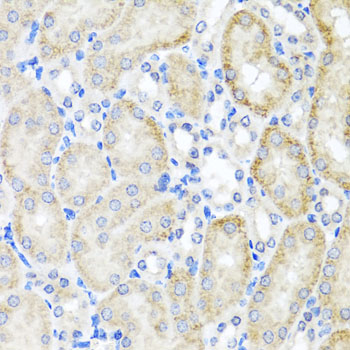 PSTPIP1 Rabbit polyclonal antibody