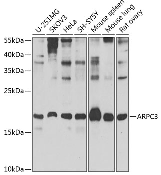 ARPC3 Rabbit polyclonal antibody