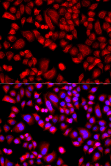 ARPC3 Rabbit polyclonal antibody