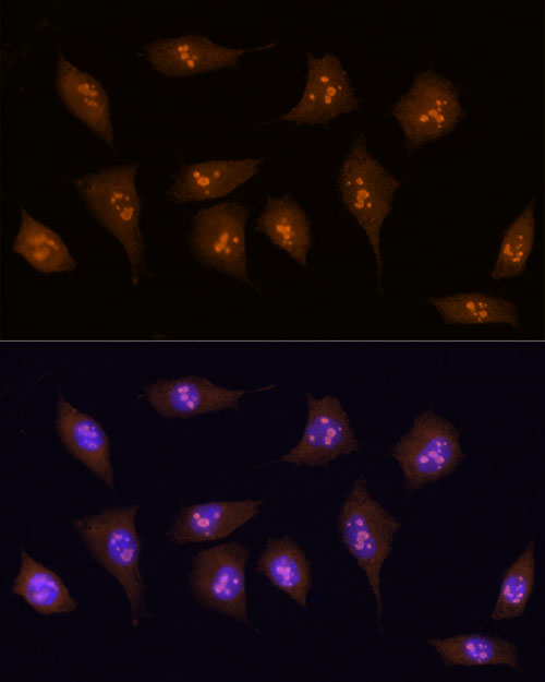 [KO Validated] KDM5B Rabbit polyclonal antibody