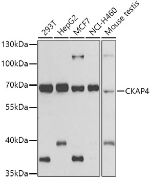 CKAP4 Rabbit polyclonal antibody