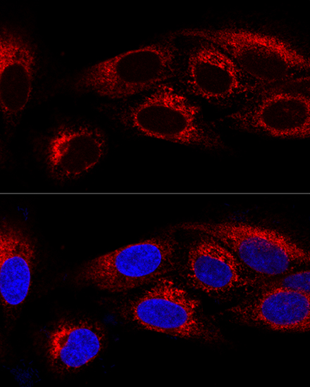 CKAP4 Rabbit polyclonal antibody