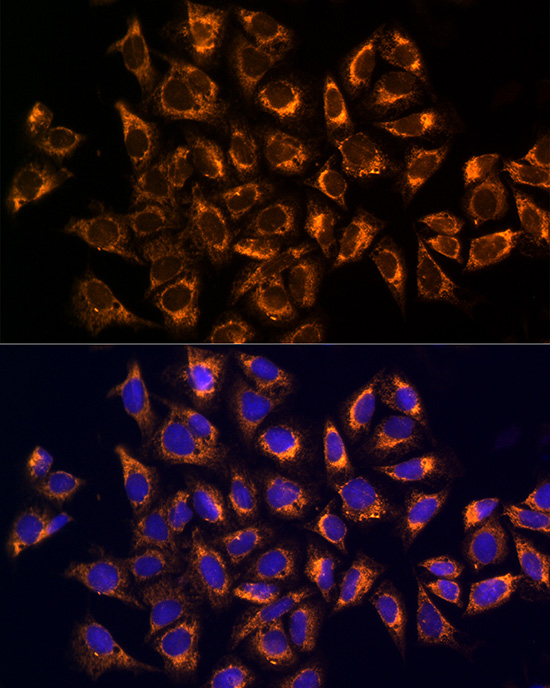 CKAP4 Rabbit polyclonal antibody