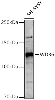 WDR6 Rabbit polyclonal antibody