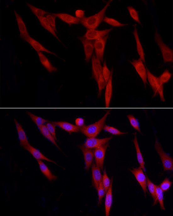 WDR6 Rabbit polyclonal antibody