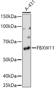 FBXW11 Rabbit polyclonal antibody