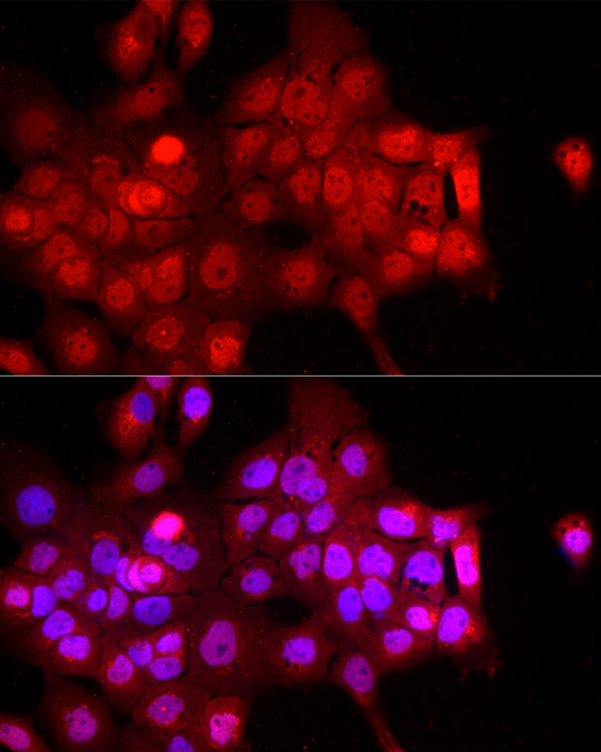FBXW11 Rabbit polyclonal antibody