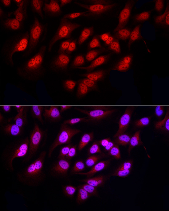 FBXW11 Rabbit polyclonal antibody