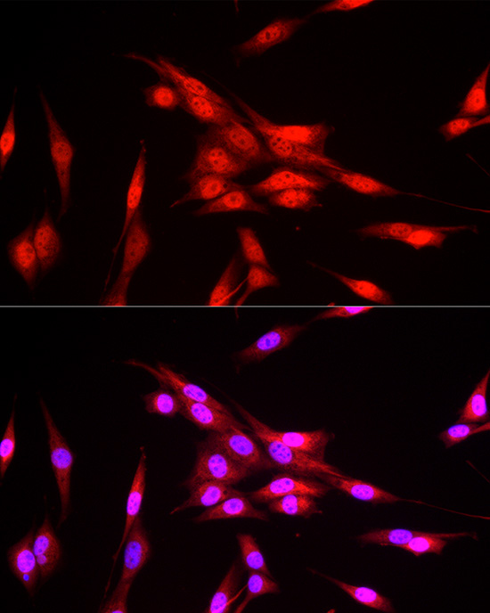 FBXW11 Rabbit polyclonal antibody