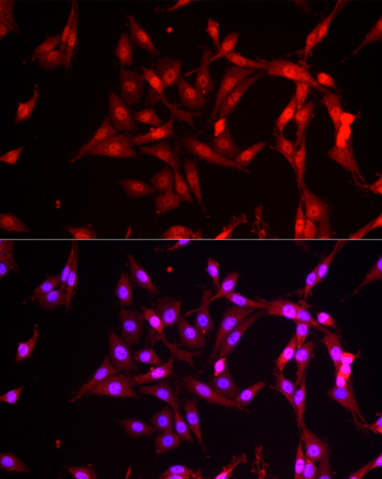 FBXW11 Rabbit polyclonal antibody