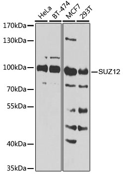 [KO Validated] SUZ12 Rabbit polyclonal antibody