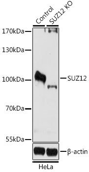 [KO Validated] SUZ12 Rabbit polyclonal antibody