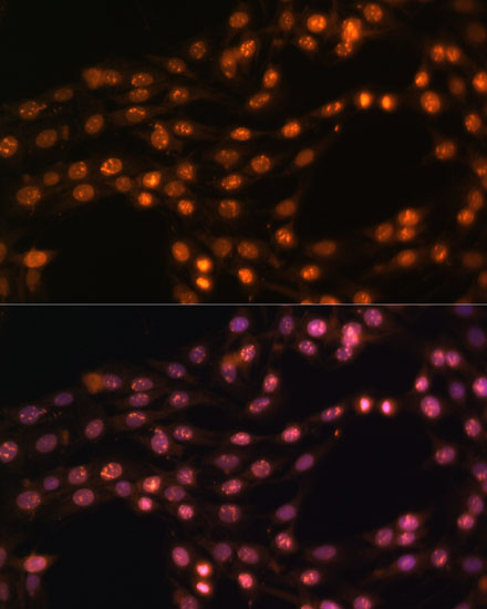 [KO Validated] SUZ12 Rabbit polyclonal antibody