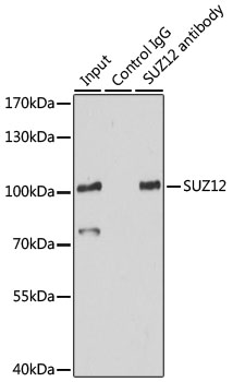 [KO Validated] SUZ12 Rabbit polyclonal antibody