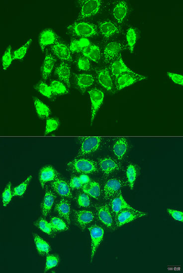 RASGRP3 Rabbit polyclonal antibody