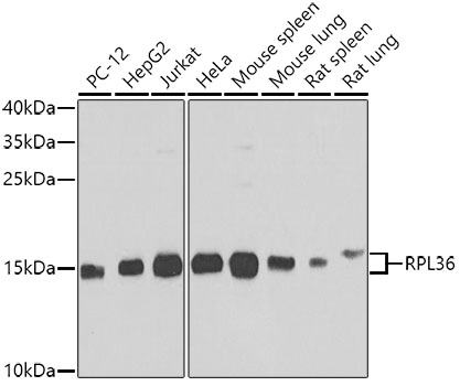 RPL36 Rabbit polyclonal antibody