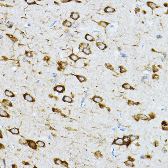 RPL36 Rabbit polyclonal antibody