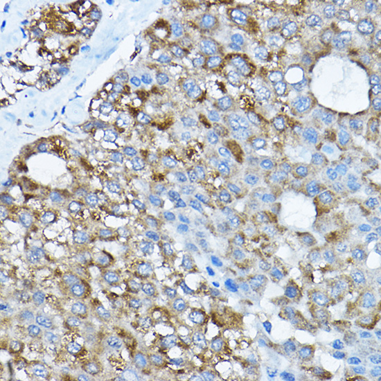 RPL36 Rabbit polyclonal antibody