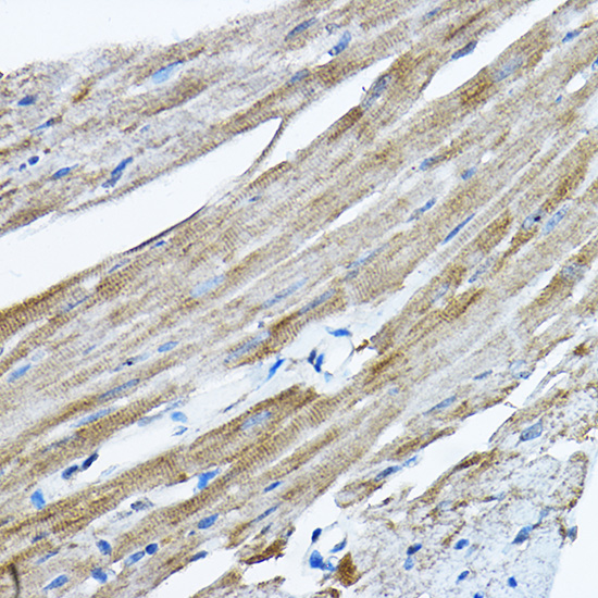 RPL36 Rabbit polyclonal antibody