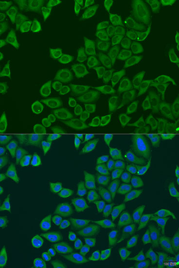 RPL36 Rabbit polyclonal antibody