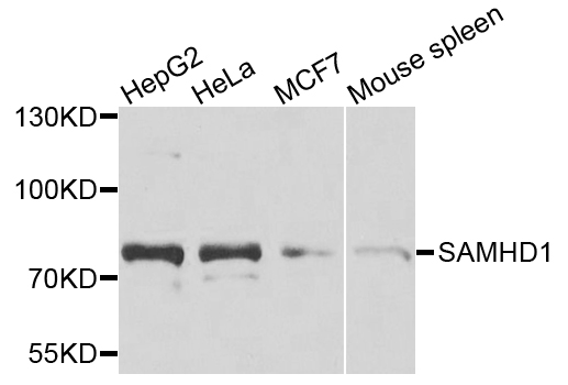 [KO Validated] SAMHD1 Rabbit polyclonal antibody