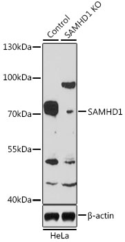 [KO Validated] SAMHD1 Rabbit polyclonal antibody