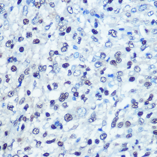 [KO Validated] SAMHD1 Rabbit polyclonal antibody