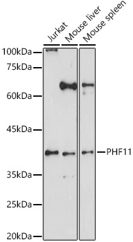 PHF11 Rabbit polyclonal antibody