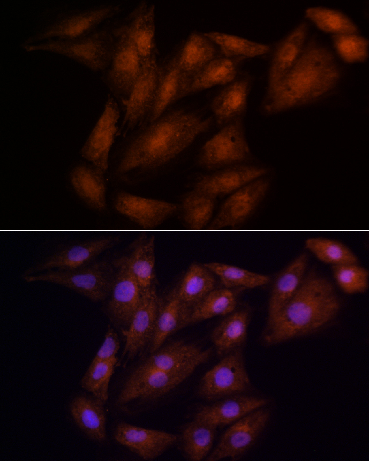 ECSIT Rabbit polyclonal antibody