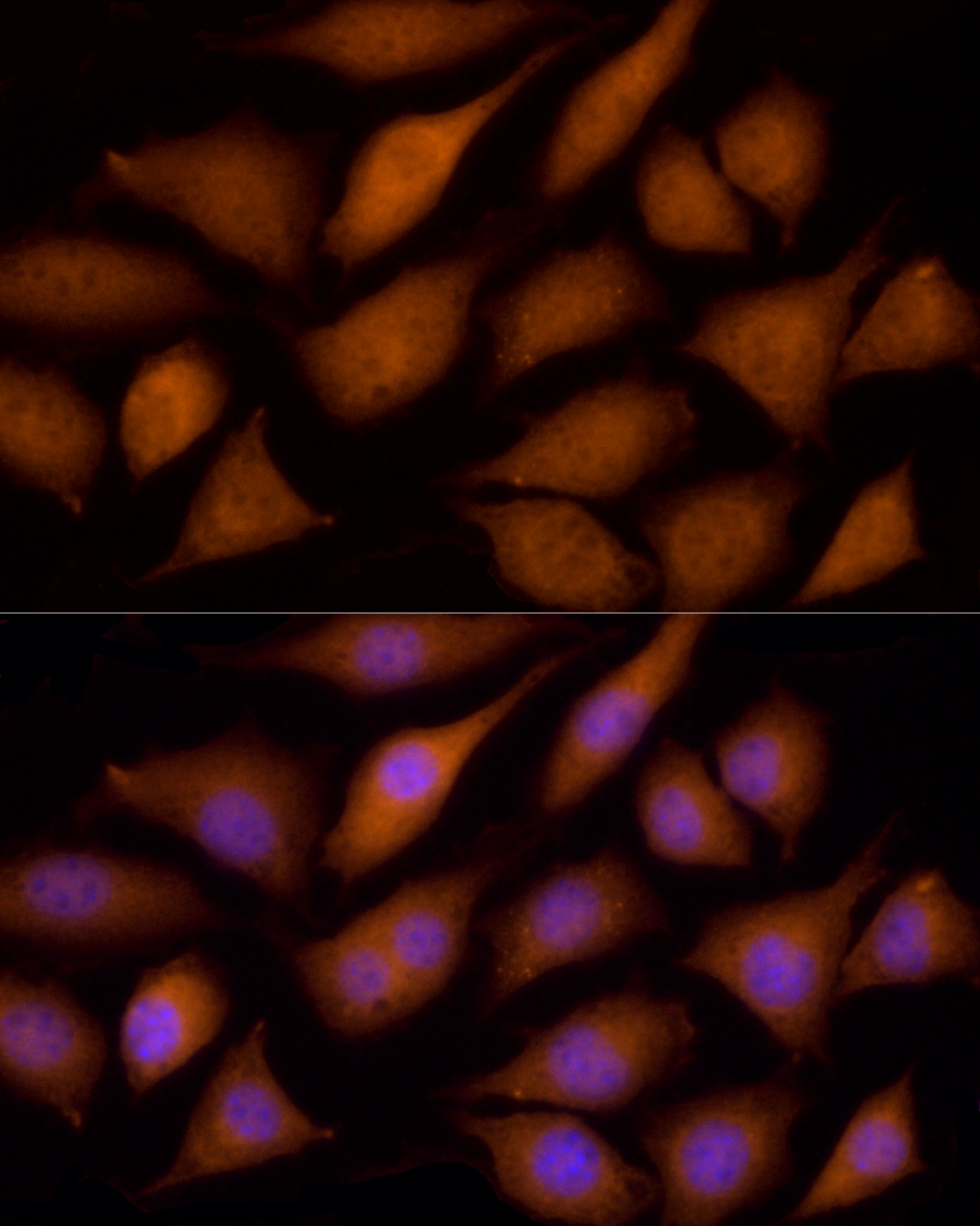 ECSIT Rabbit polyclonal antibody