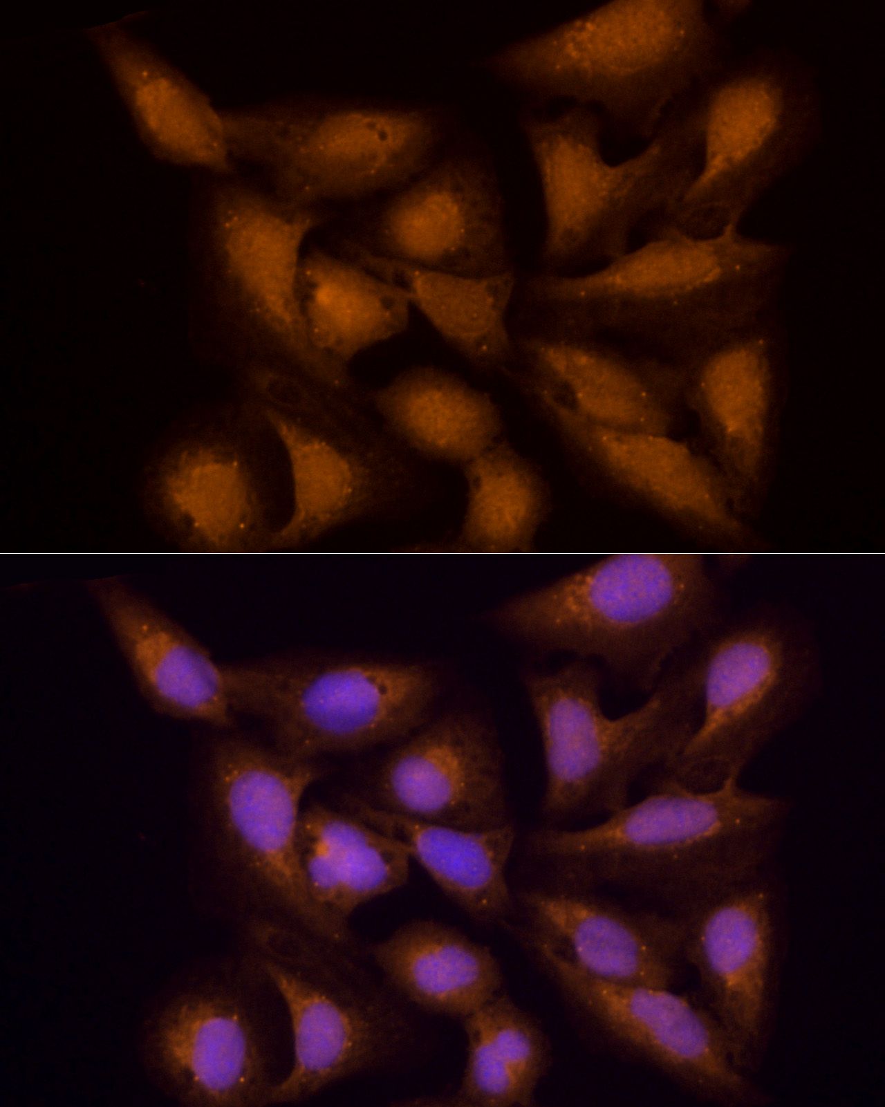 ECSIT Rabbit polyclonal antibody