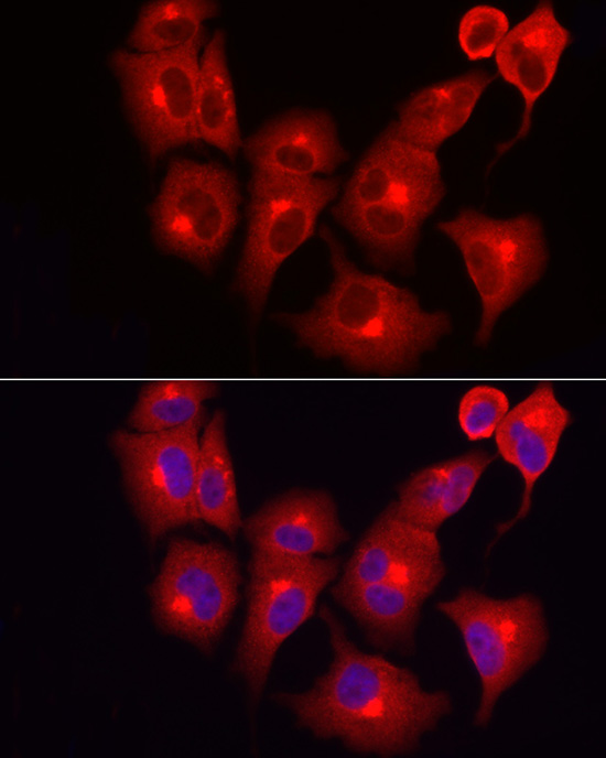 INPP5K Rabbit polyclonal antibody