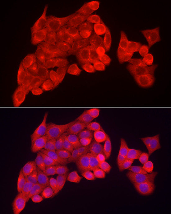 INPP5K Rabbit polyclonal antibody