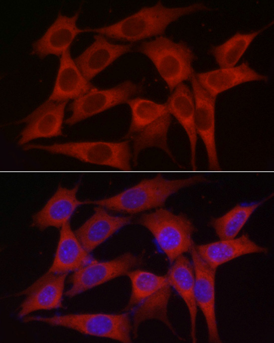 INPP5K Rabbit polyclonal antibody