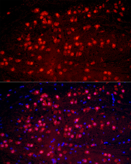 RBFOX1 Rabbit polyclonal antibody