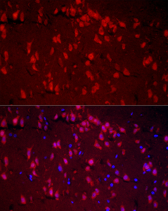 RBFOX1 Rabbit polyclonal antibody