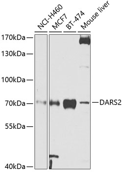 DARS2 Rabbit polyclonal antibody